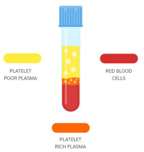 platelet blood transfusion